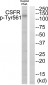 CSFR (Phospho-Tyr561) Antibody