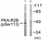 PKA-R2β (Phospho-Ser113) Antibody
