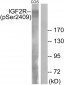 IGF2R (Phospho-Ser2409) Antibody