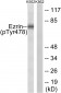 Ezrin (Phospho-Tyr478) Antibody