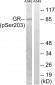 GR (Phospho-Ser203) Antibody