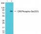 GR (Phospho-Ser203) Antibody