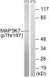 MAP3K7 (Phospho-Thr187) Antibody