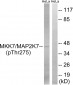 MAP2K7 (Phospho-Thr275) Antibody