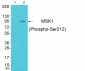 MSK1 (Phospho-Ser212) Antibody