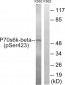p70 S6 Kinase β (Phospho-Ser423) Antibody