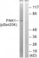 PAK1 (Phospho-Ser204) Antibody