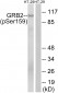GRB2-associated-binding protein 2 (Phospho-Ser159) Antibody