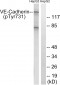 VE-Cadherin (Phospho-Tyr731) Antibody