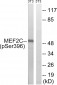 MEF2C (Phospho-Ser396) Antibody