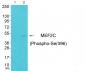 MEF2C (Phospho-Ser396) Antibody