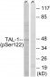 TAL-1 (Phospho-Ser122) Antibody