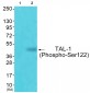 TAL-1 (Phospho-Ser122) Antibody