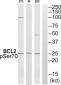 BCL2 (Phospho-Ser70) Antibody