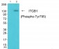 ITGB1 (Phospho-Tyr795) Antibody
