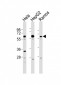 GRK5 Antibody (C-term)