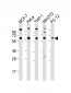 Pyruvate Kinase (PKM2) Antibody (N-term)