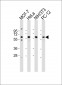 Pyruvate Kinase (PKM2) Antibody (N-term)