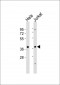 MAPK12 Antibody (Center)