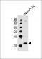 EN2 Antibody (C-term)