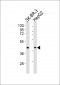 ACAT1 Antibody (C-term)