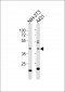 E2F1 Antibody (H357)