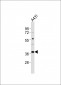 MICA Antibody (Center)