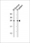 SOCS1 Antibody (N-term)