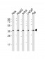 DFFB Antibody (N-term)