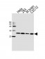 HIP2 (UBE2K) Antibody(N-term)