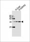 ECHDC3 Antibody (N-term)