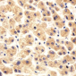Serum amyloid P-component(1-203) Antibody (Center)