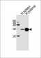 Serum amyloid P-component(1-203) Antibody (Center)