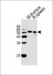 Mouse Hck Antibody (Center)