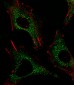 CTSD Antibody