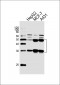 CTSD Antibody