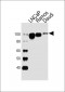 MME Antibody (N-term)