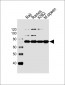 BTK Antibody (Center)