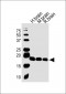 VILIP1 Antibody (C-term)