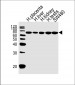 TRPV6 Antibody (Center)