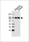 PTK2B Antibody (C-term)