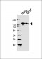 GTF2I Antibody (C-term)