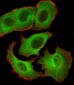 SMAD1 Antibody (Center)