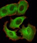 SMAD1 Antibody (Center)