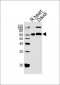 PACSIN2 Antibody (C-term)