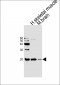 CFL2 Antibody (C-term)