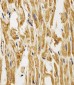 FABP3 Antibody