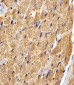 FABP3 Antibody