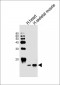 FABP3 Antibody