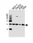 PMM2 Antibody (C-term)